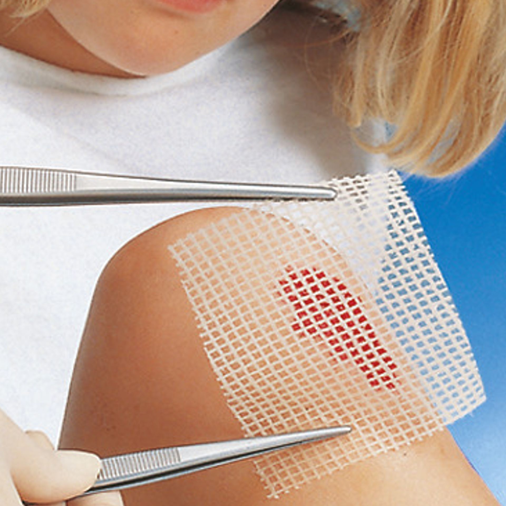 Grassolind Compressas