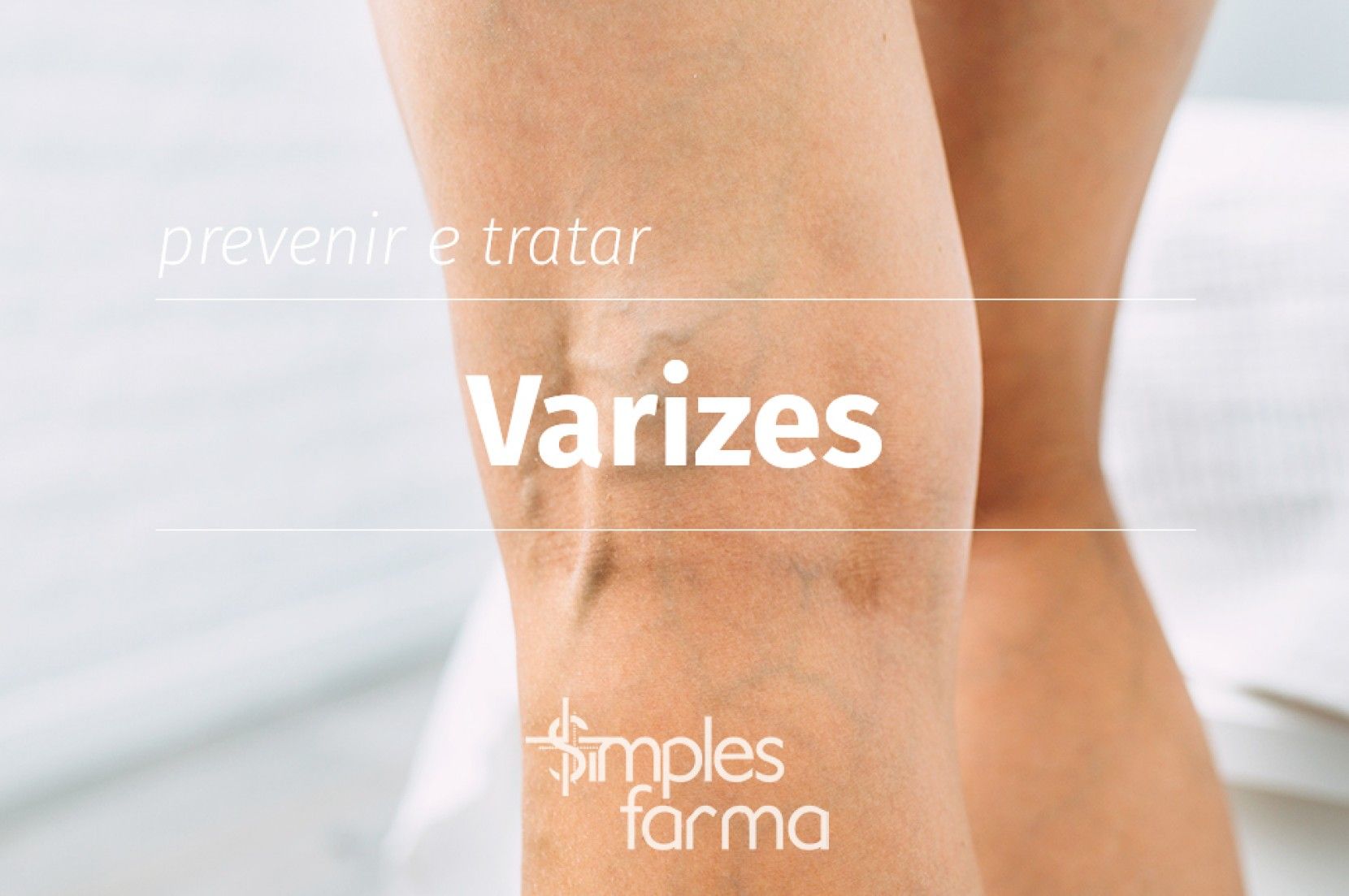 Varizes: Prevenir e Tratar
