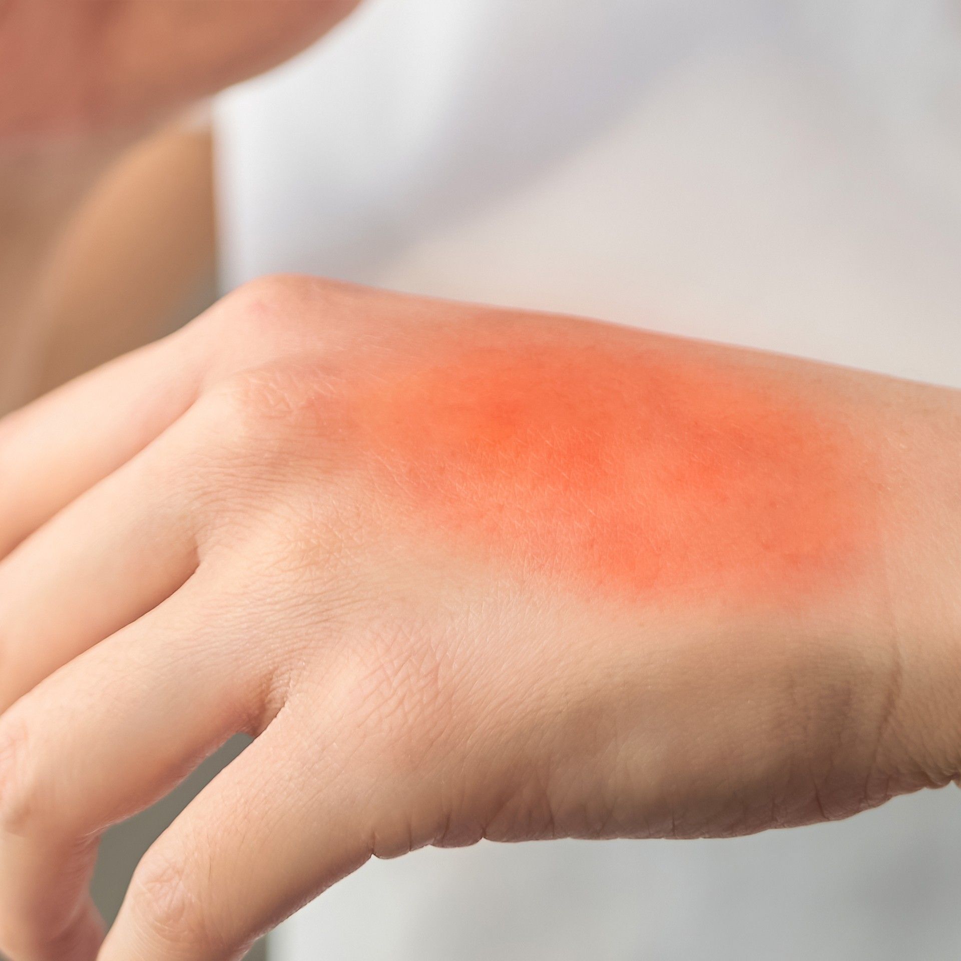 Terapharma Alerpik Gel 50 ml