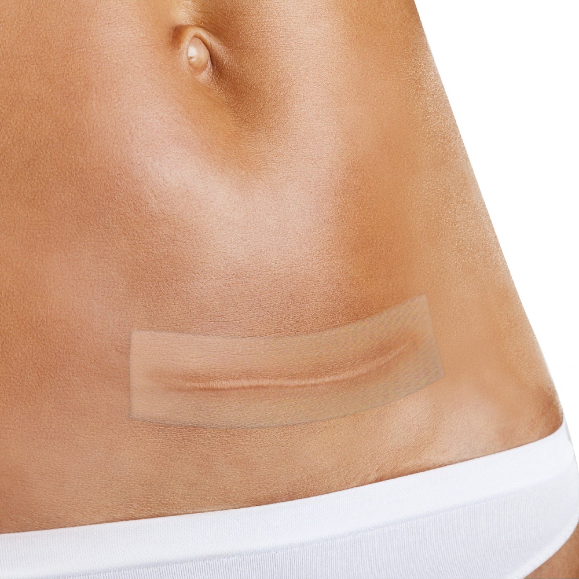 Folha de Silicone para Tratamento de Cicatrizes